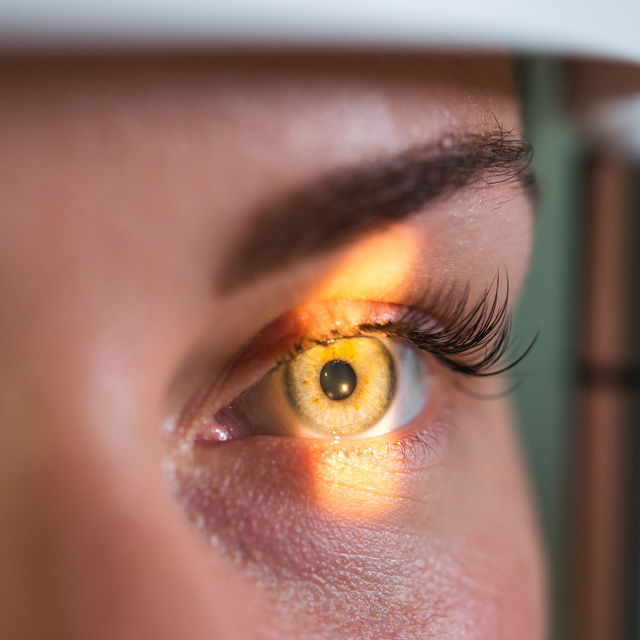 Vision Therapy in Marcy Holmes